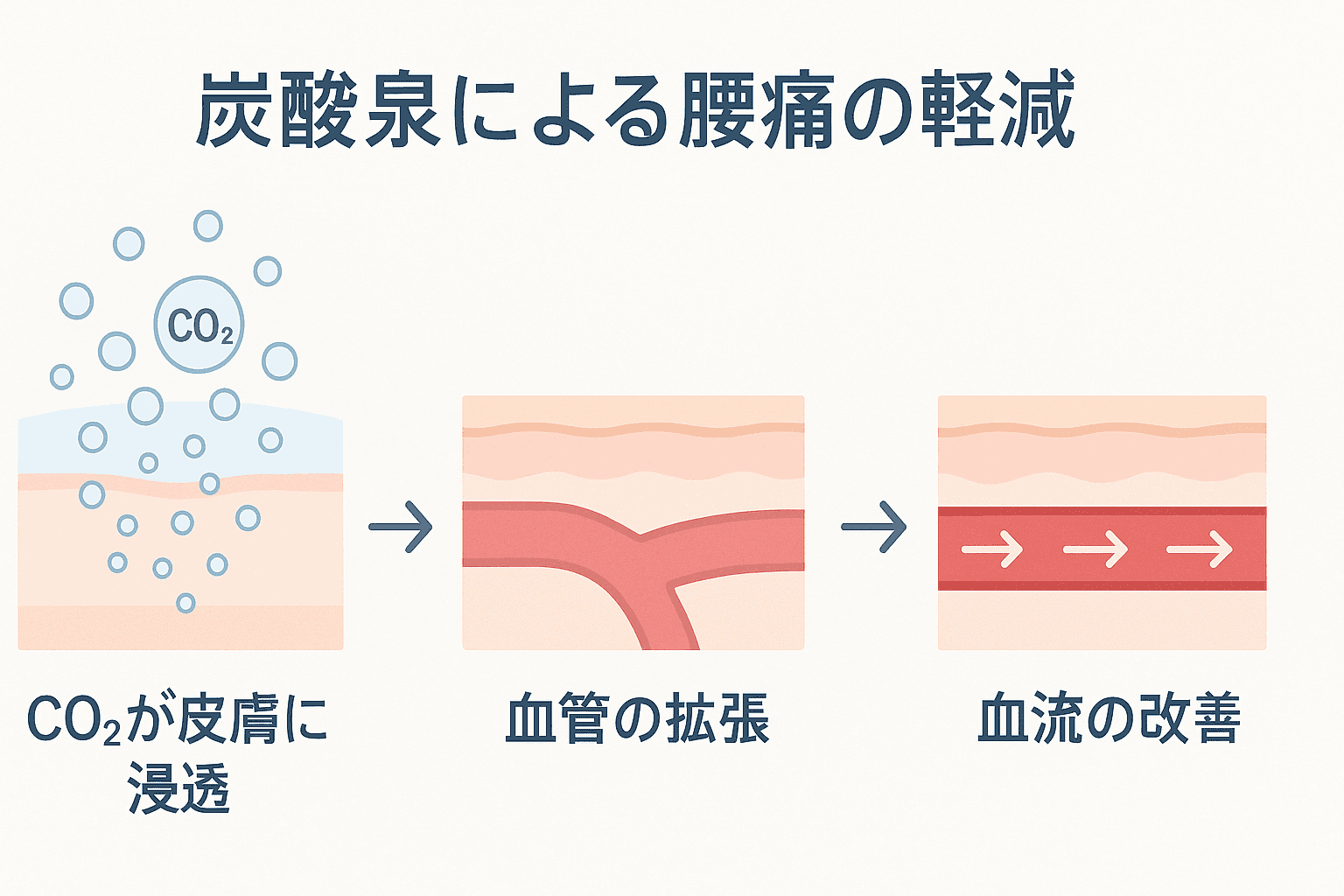 炭酸泉が腰痛に効くメカニズムの解説図:CO2が皮膚に浸透し血管を拡張させ血流を改善する3つのステップを図解