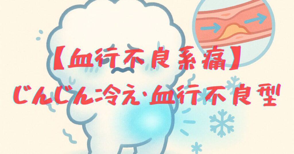 血行不良系腰痛のイラスト - 冷えによるじんわりとした痛みと血流の滞りを表現